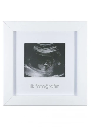İlk Fotoğrafım Bebek Ultrason Çerçevesi - Bebek Odası Resim Anı Çerçevesi