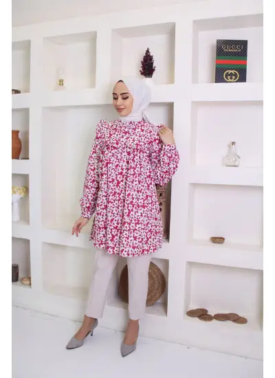 Moda Çizgi Desenli Tunik